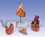 Classic Heart Anatomy with Thymus, 3 part model